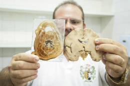 Imagem: Técnica em Anatomia apresenta esculturas de peças anatômicas