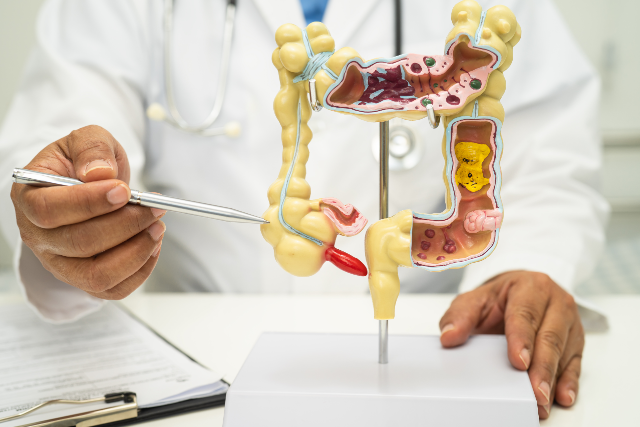 Imagem: homem mostra peça anatômica de intestino