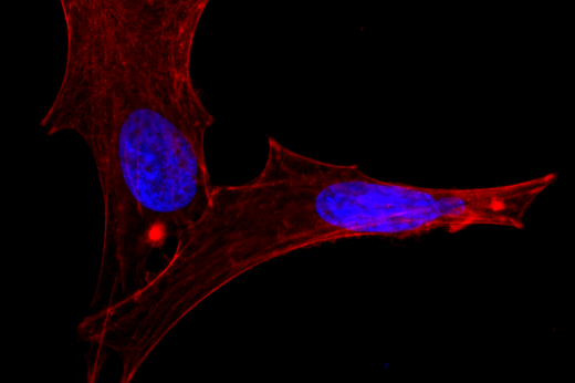 Imagem de microscópio de célula, de cor vermelha, com dois núcleos azuis, em fundo preto